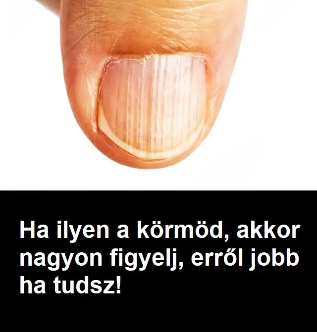 korom
