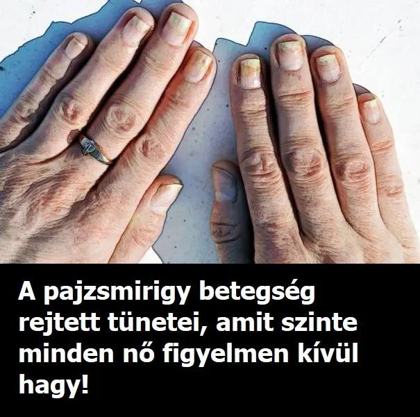 lemezes korom
