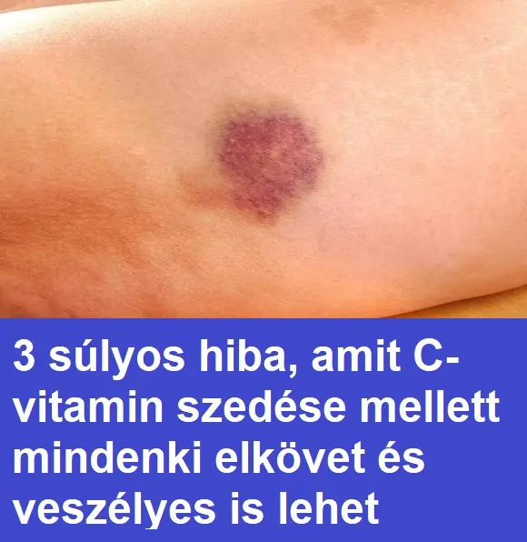 vvitamin